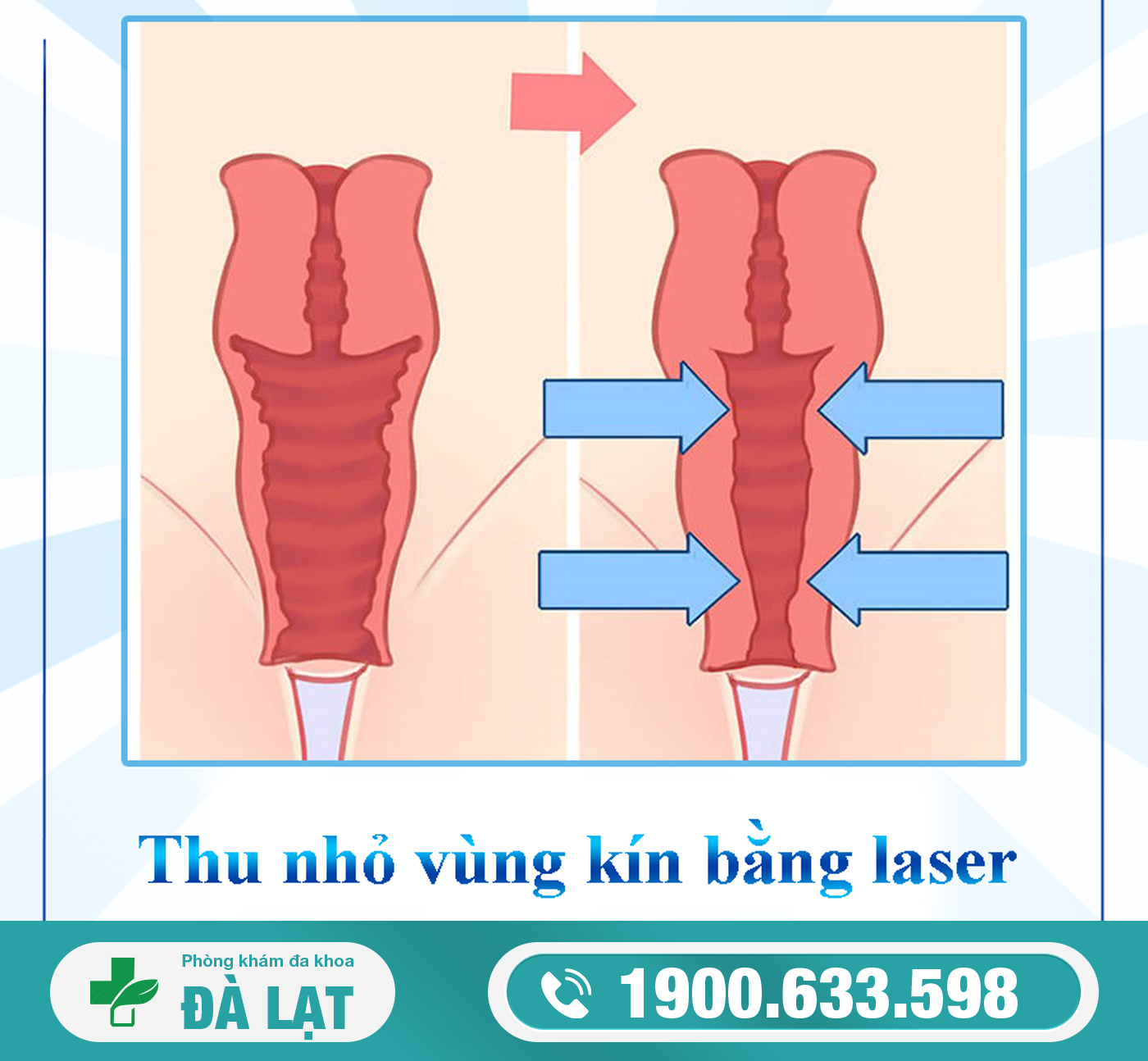 Block Image